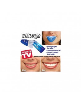 Система за домашно избелване на зъбите WHITELIGHT